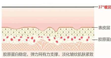 热玛吉会反弹吗，效果能持续多久